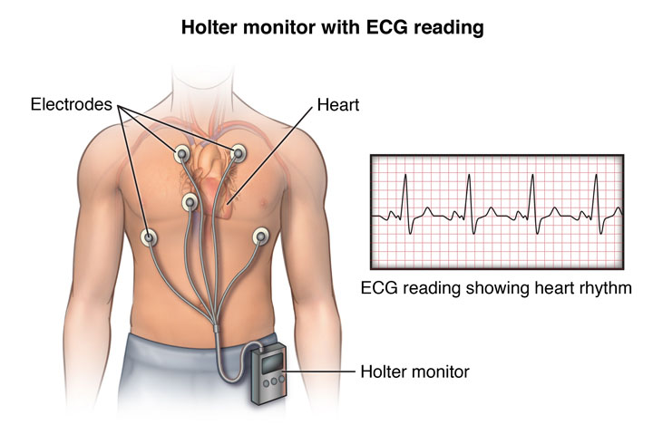 Holter Monitoring - SND Hospital Ropar